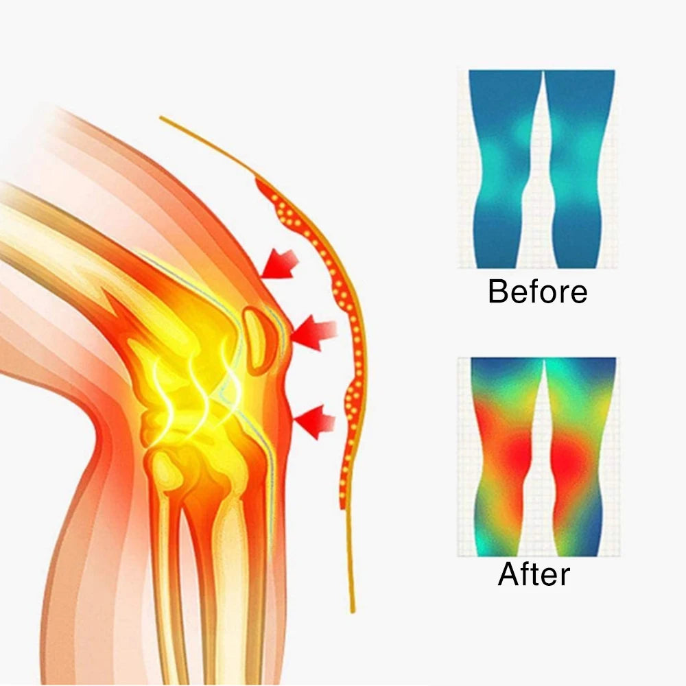 Tourmaline Self-heating Massage Knee Support Brace Magnetic Therapy Belt Pad Sleeve Health Care Pain Relief Relaxation
