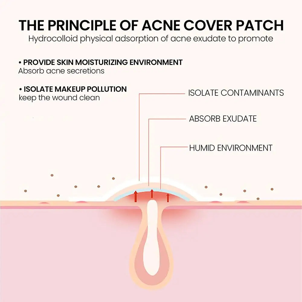 200 Counts Colorful Hydrocolloid Cute Star Shaped Acne Pimple Patch For Face Invisible Zit Cover Stickers Skin Care