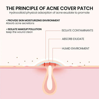 200 Counts Colorful Hydrocolloid Cute Star Shaped Acne Pimple Patch For Face Invisible Zit Cover Stickers Skin Care