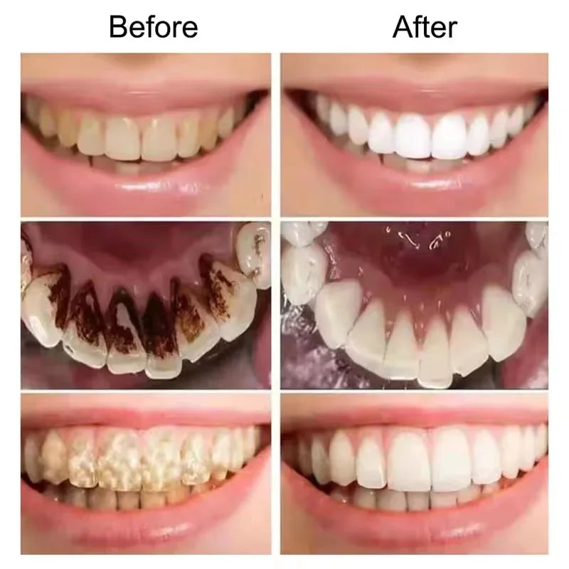 Teeth Whitening Toothpaste