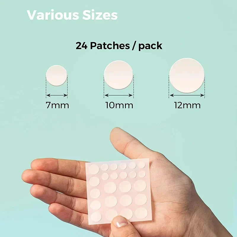 Acne Spot Treatment Patches