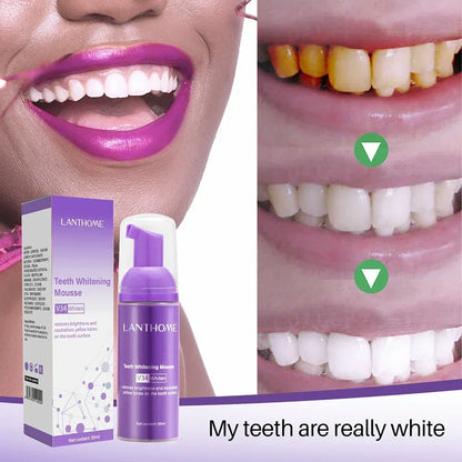 V34 Mousse Toothpaste Teeth Whitening Removing Yellow Teeth Cleaning Tooth Stain Oral Fresh Tooth Care Product 50ml 2024 New
