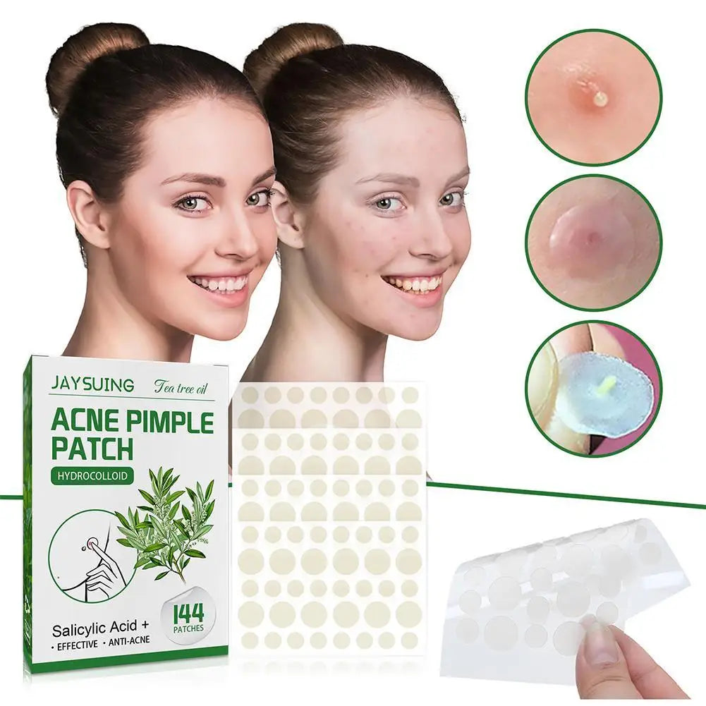144pcs Hydrocolloid Salicylic Acid Acne Pimple Patches Treatment For Zits Blemishes Tea Tree Oil Acne Patch Redness Repair Care