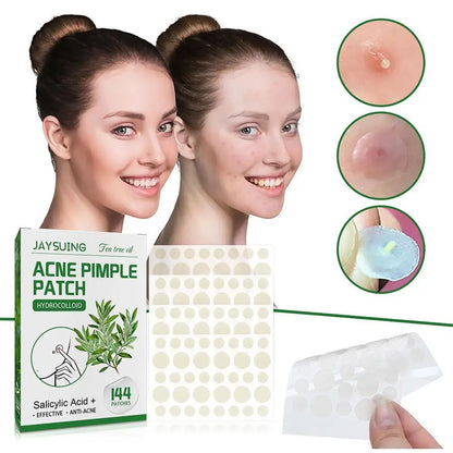 144pcs Hydrocolloid Salicylic Acid Acne Pimple Patches Treatment For Zits Blemishes Tea Tree Oil Acne Patch Redness Repair Care