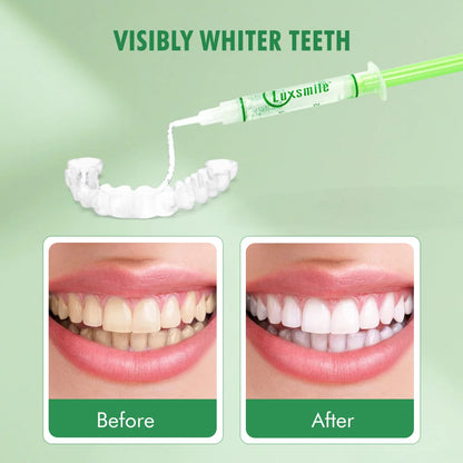 15 Pcs Tooth Whitening Gel PAP Dental Whitening Gel Oral Care Teeth Whitener Bleaching Whitening Gel Tooth Whitening Kit cleaner