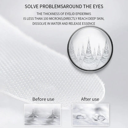Hyaluronic Acid Microcrystals Eye Patches Mask For Anti Wrinkle Aging Dark Circles Moisturizing Under Eye Gel Pads Skin Care