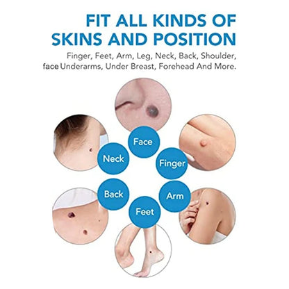 Wart Removing Pen Set Skin Care Body Wart Dot Treatments Remover Cleaning Tools Double Head Wart Removal Tool Set
