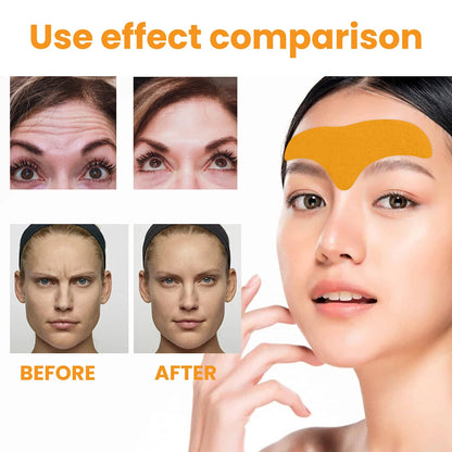 10pcs/30pcs Forehead Wrinkle Patches Anti-aging Wrinkle Line Removal Gel Patch Anti Wrinkles Lifting&Tightening Face Skin Care