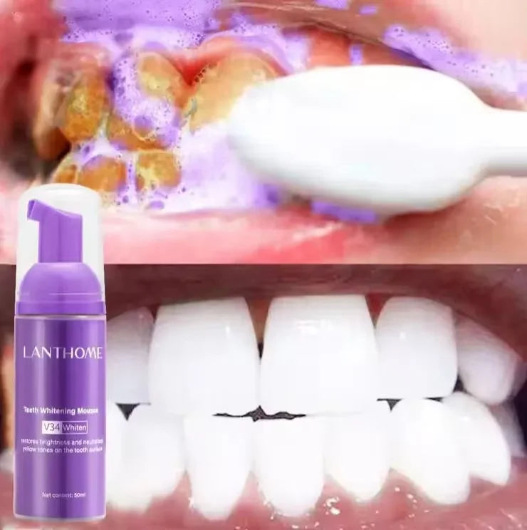 Teeth Whitening Toothpaste