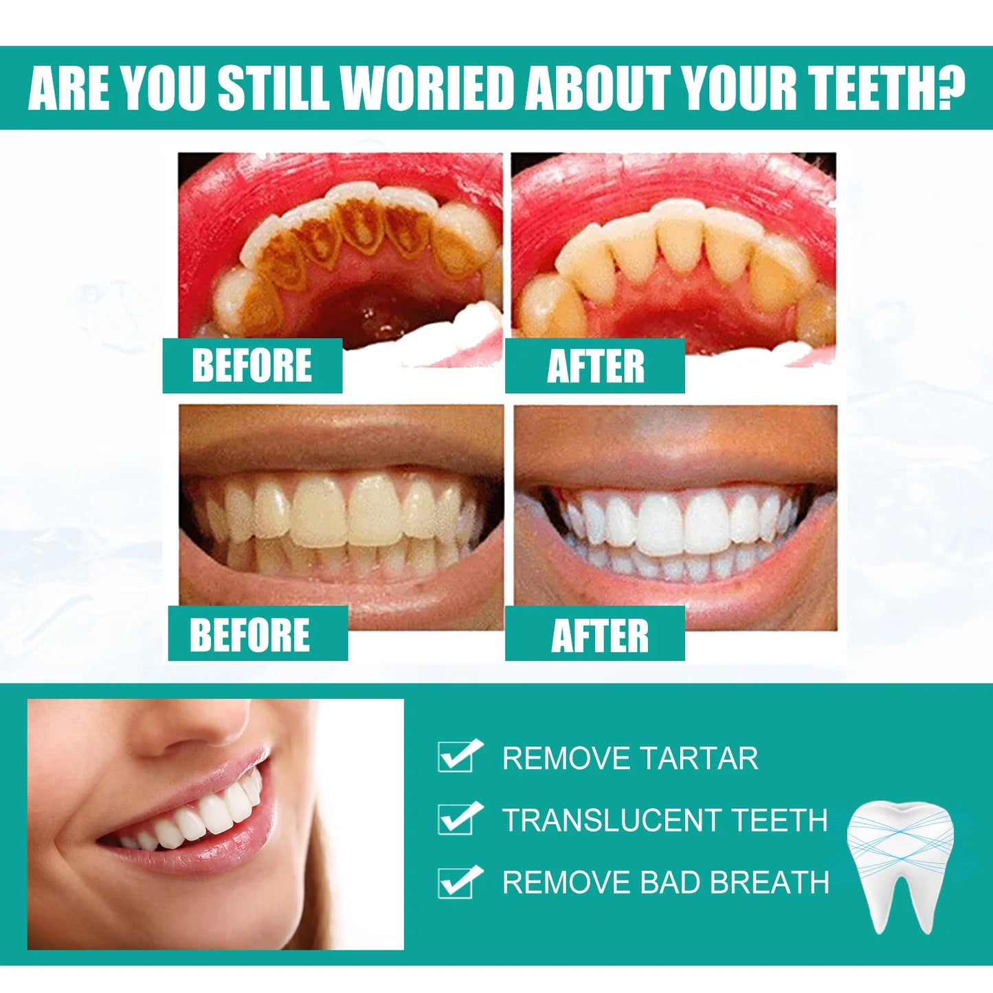 5 Days Teeth Whitening Powder Toothpaste Remove Plaque Stains Dental Calculus Oral Hygiene Cleaning Fresh Bad Breath Tooth Care