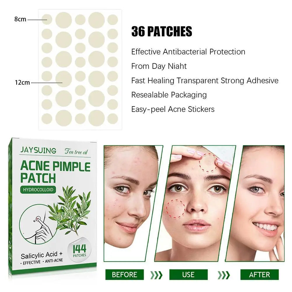 144pcs Hydrocolloid Salicylic Acid Acne Pimple Patches Treatment For Zits Blemishes Tea Tree Oil Acne Patch Redness Repair Care