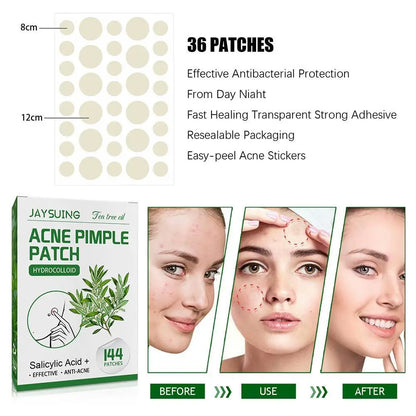 144pcs Hydrocolloid Salicylic Acid Acne Pimple Patches Treatment For Zits Blemishes Tea Tree Oil Acne Patch Redness Repair Care