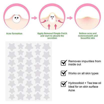 40Pcs/sheet Colorful Cute Star Heart Shaped Treatment Sticker Invisible Cover Removal Pimple Patch Skin Care