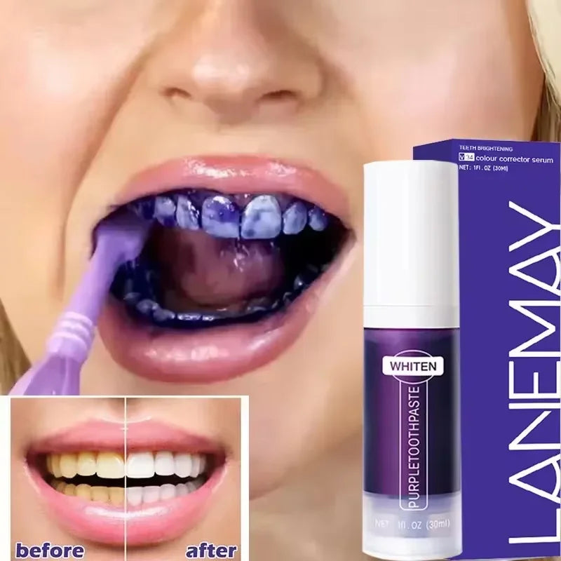 Teeth Whitening Toothpaste