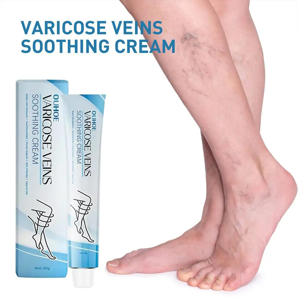 Improve Blood Circulation Varicose Veins Treatment Cream Fast-Acting Reduce Leg Swelling Wellness Cream Soothes Tired