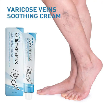 Improve Blood Circulation Varicose Veins Treatment Cream Fast-Acting Reduce Leg Swelling Wellness Cream Soothes Tired