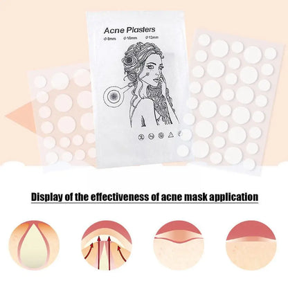 24/36pcs Face Skin Care Acne Pimple Patch 2 Sizes Invisible Healing Spot Women Covering Men Sticker Absorbing Professional O5Z2