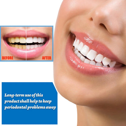 Tooth Whitening Removes Plaque Stains Tooth Bleaching Cleaning Whitening Teeth Oral Hygiene Tooth Whitening Prod