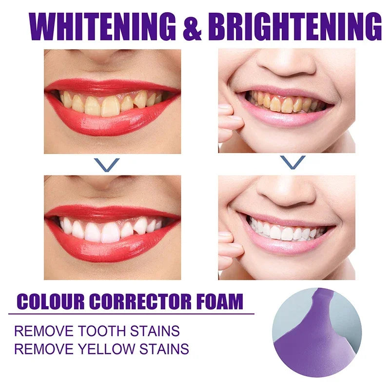 V34 Mousse Toothpaste 50ml Teeth Whitening Removing Yellow Teeth Cleaning Tooth Stain Oral Fresh Tooth Oral Cleaning Product