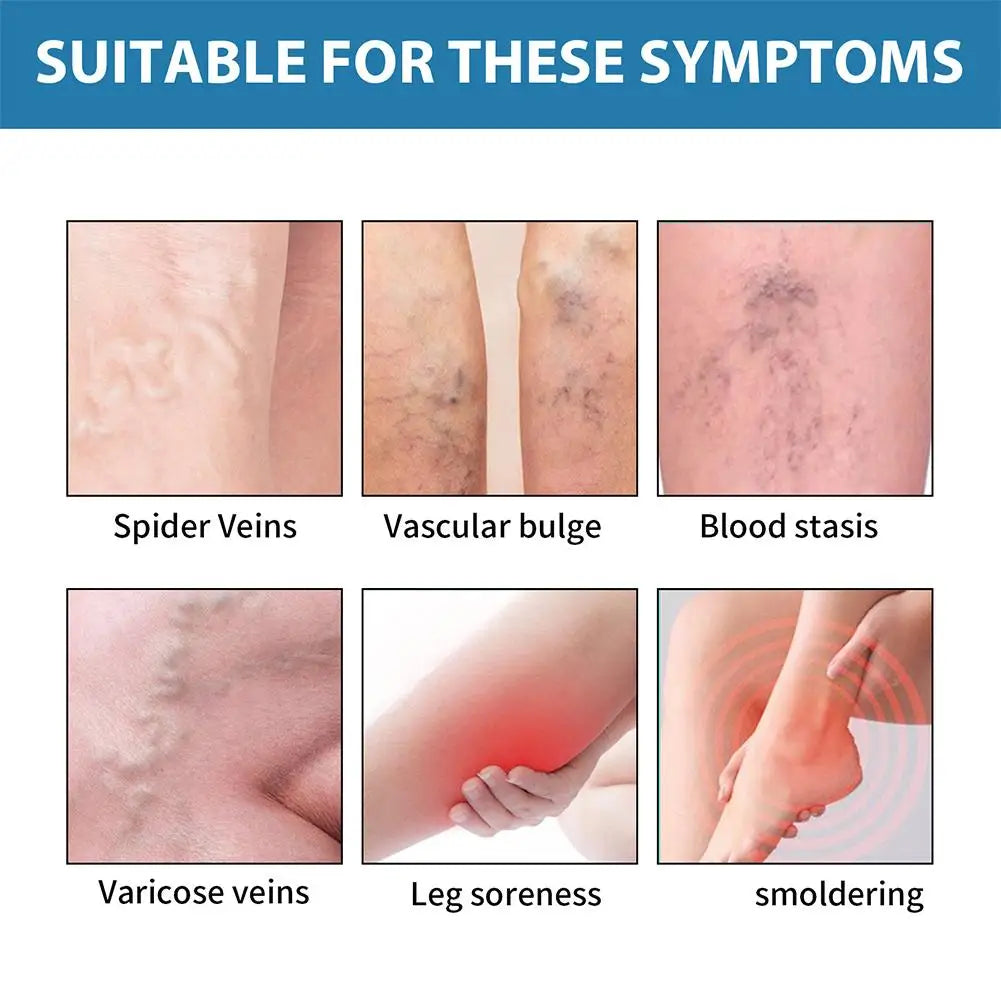 Improve Blood Circulation Varicose Veins Treatment Cream Fast-Acting Reduce Leg Swelling Wellness Cream Soothes Tired