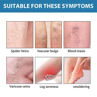 Improve Blood Circulation Varicose Veins Treatment Cream Fast-Acting Reduce Leg Swelling Wellness Cream Soothes Tired