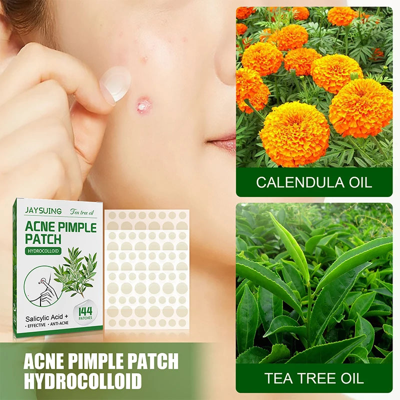 144Pcs Acne Pimple Patch Stickers Waterproof Acne Treatment Pimple Remover Tool Blemish Spot Facial Mask Skin Care