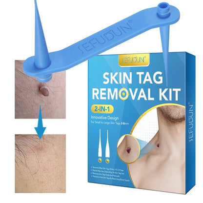 Skin Tag Removal Kit Home Mole Wart Puntos Negros Remover Equipment Micro Skin Tag Removeal Tool Easy To Clean Skin Care Tool
