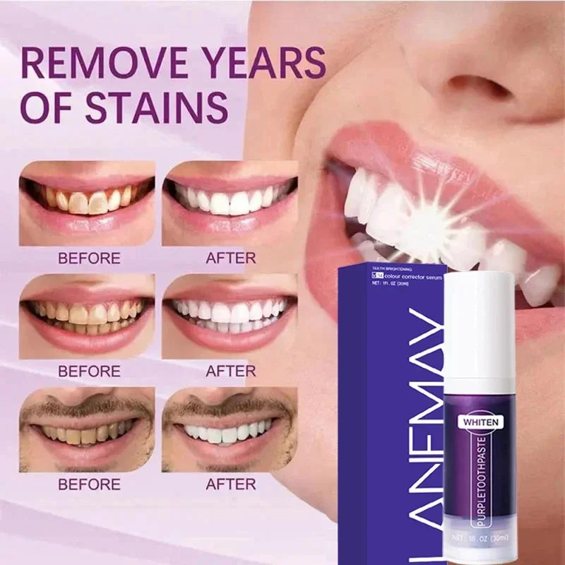 Teeth Whitening Toothpaste