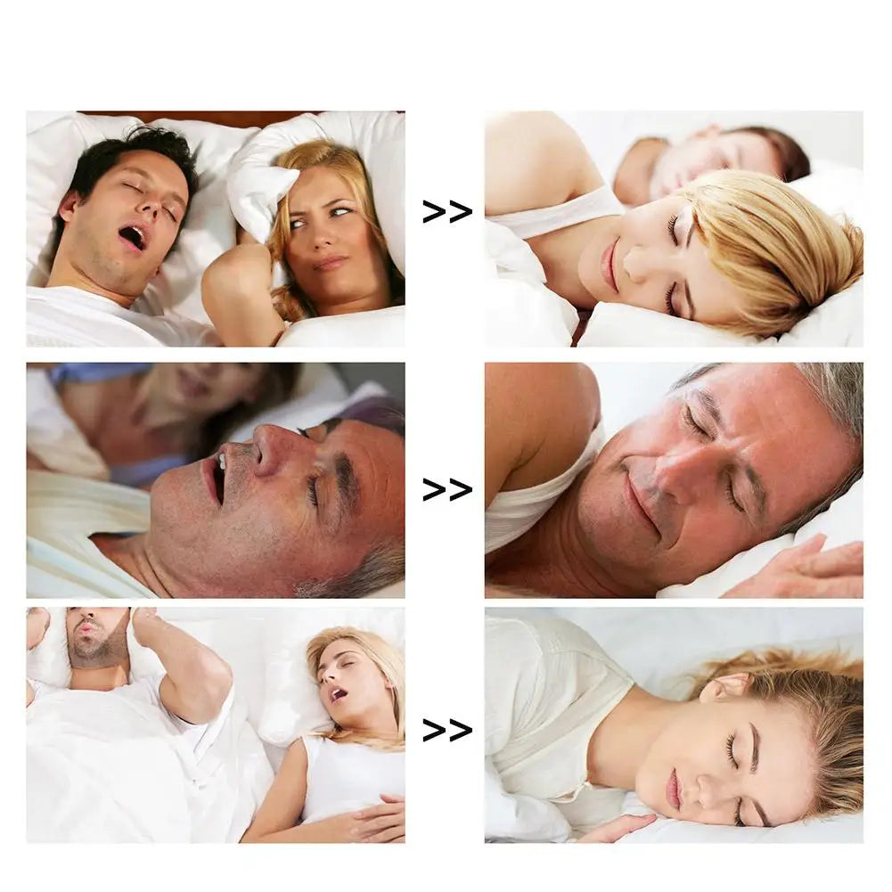 Anti-Snoring Nasal Strips