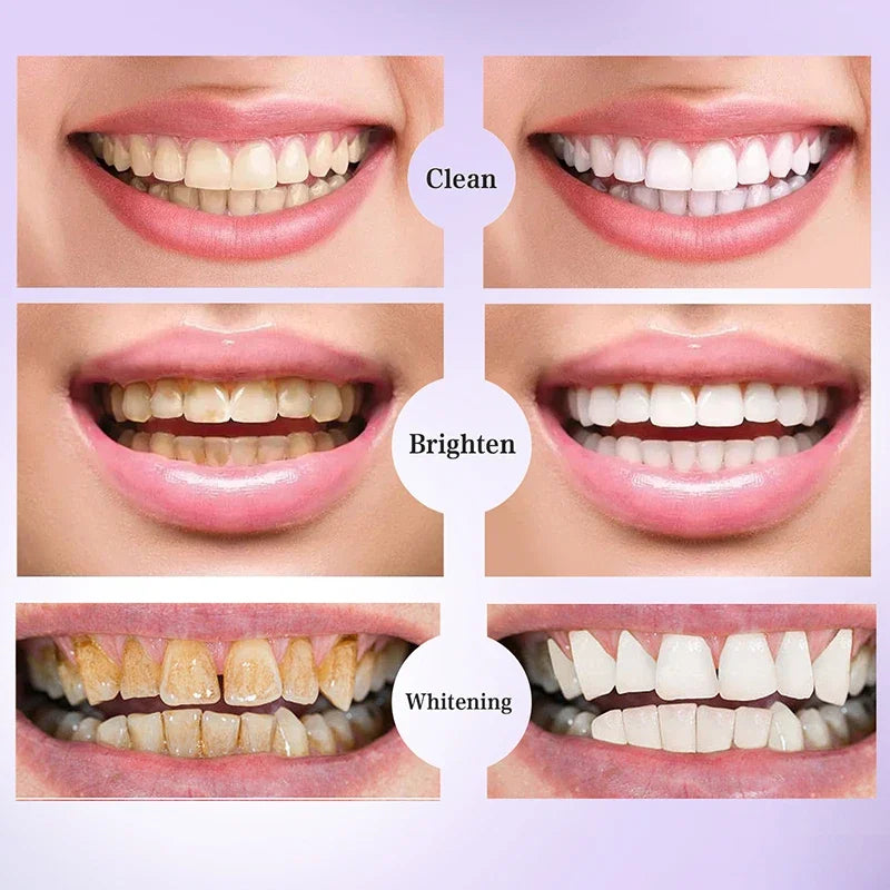 V34 Teeth Whitening Toothpaste Mousse Remove Plaque Stains Cleaning Oral Hygiene Fresh Bad Breath Dental Tooth Care Tools