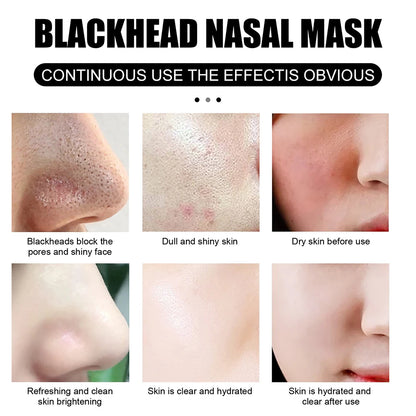 Blackhead Remover Mask Nose Mask Pore Strips Black Mask Peeling Acne Treatment Deep Cleansing Face Mask Oil Control Skin Care