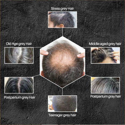 Hair Shampoo Soap Bar Cover Gray Hair Polygonum Multiflorum Dye Canas Hair Dye Shampoo Black Soap White Hair To Black Soap Cover